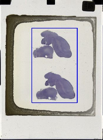 Media type: image; Special Collections 3043   shows specimen_part histological serial section;